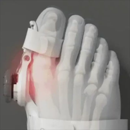 Bunion Fix Foot Tool